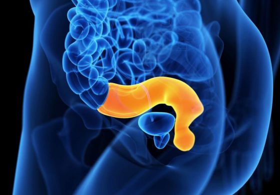 cirugía general en Valencia - enfermedadesrecto