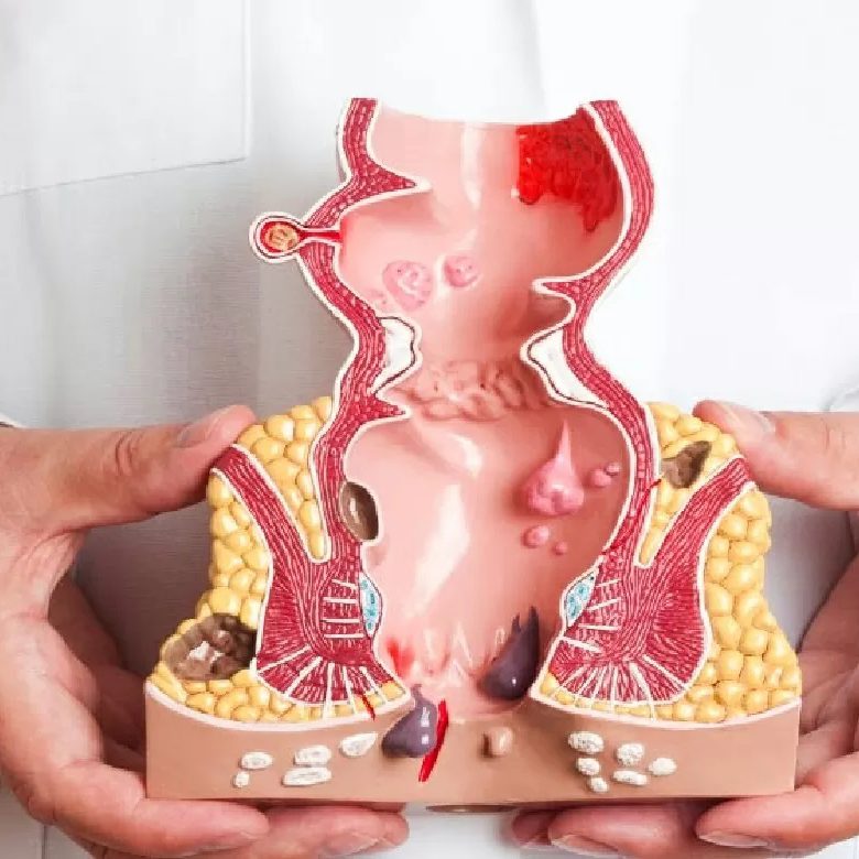 Especialistas en enfermedades de recto en Valencia - modelo