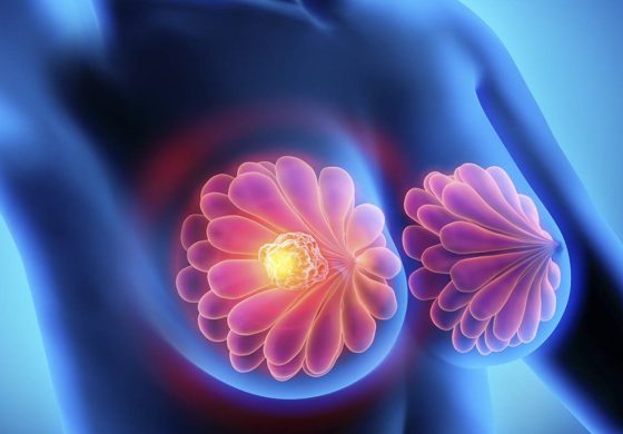 cirugia general en valencia - cirugía de mama