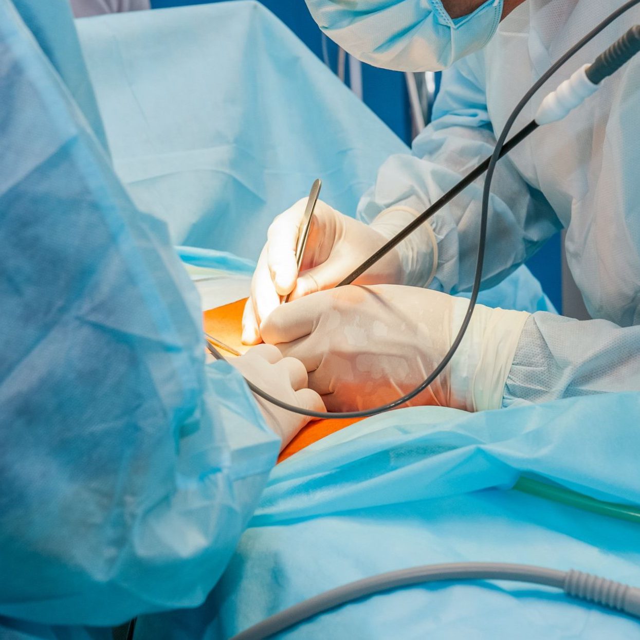 cirujano general en Valencia - operacion