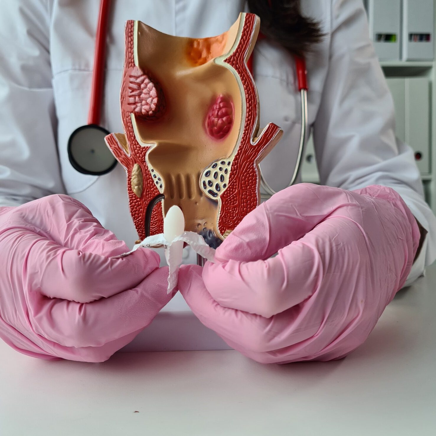 proctología en Valencia – supositorio proctología en Valencia - supositorio