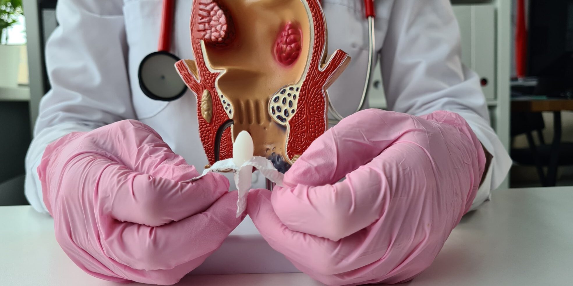 proctología en Valencia – supositorio proctología en Valencia - supositorio