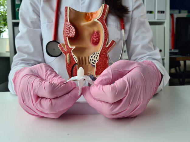 proctología en Valencia – supositorio proctología en Valencia - supositorio